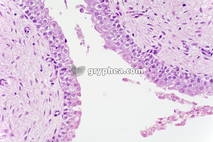Epithélium vésical (vessie) x100 - gryphea.com